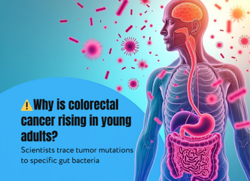 Genetic study explains rising colorectal cancer in youth ch