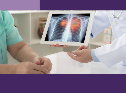 Lung Cancer Screening