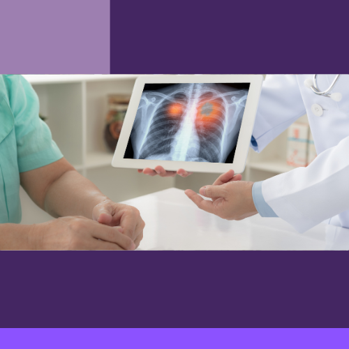 Lung Cancer Screening