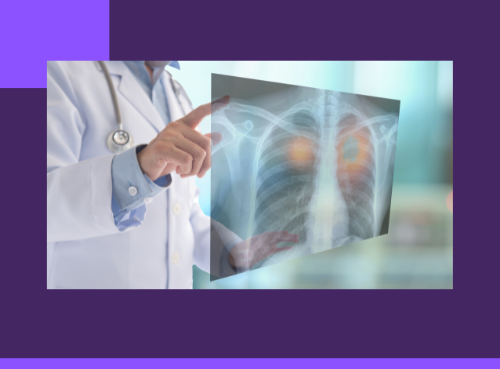 Recruitment Strategies for Lung Cancer Screening ch