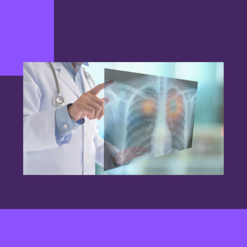 Recruitment Strategies for Lung Cancer Screening ch