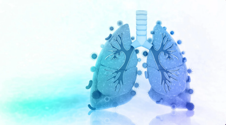 Call for experts - European Commission Initiative on Lung Cancer - now published