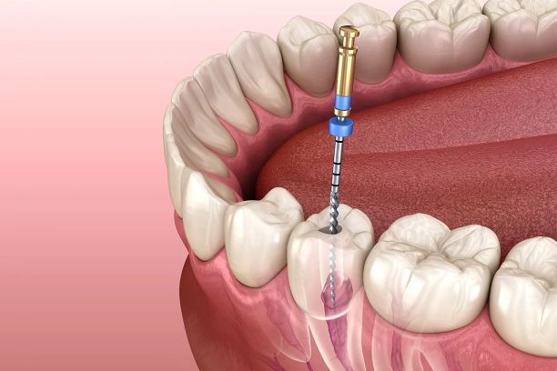 dentist 1