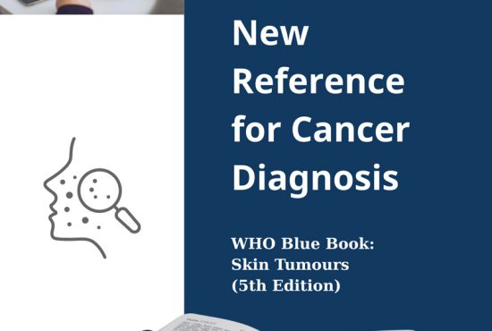 skin tumours