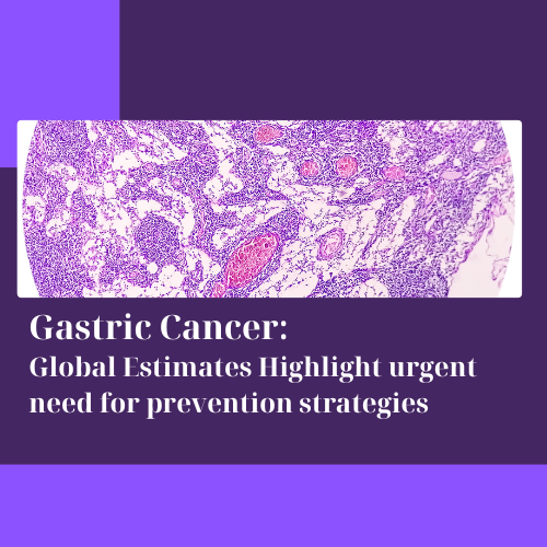 gastric cancer